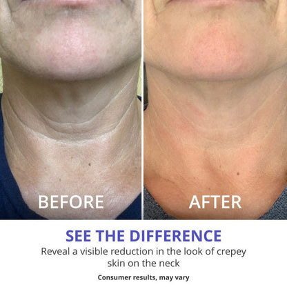 Natural™ Tighten & Lift Firming Neck Cream for Crepey Skin