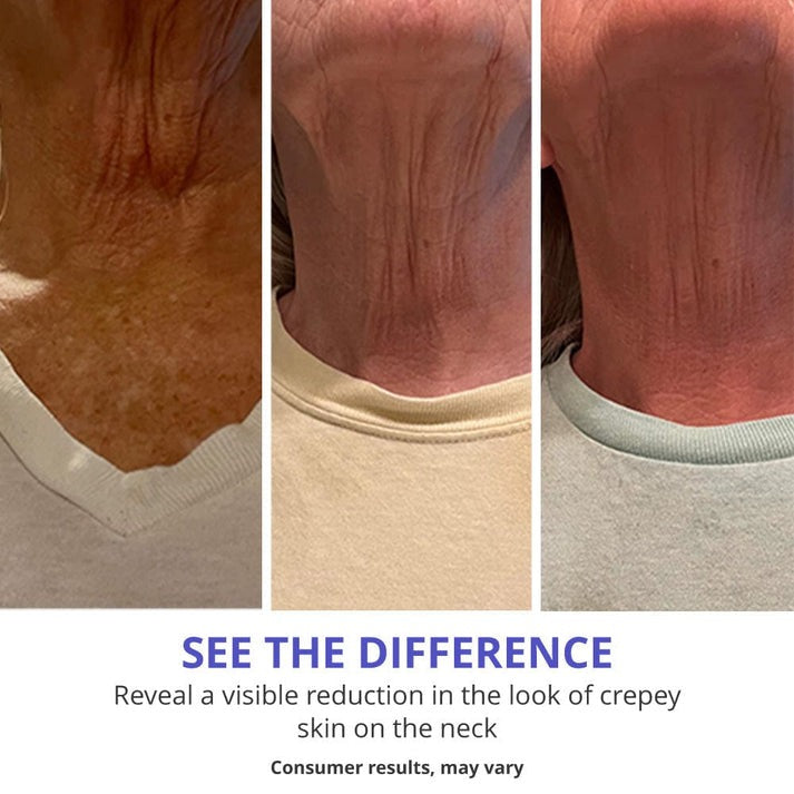 Natural™ Tighten & Lift Firming Neck Cream for Crepey Skin