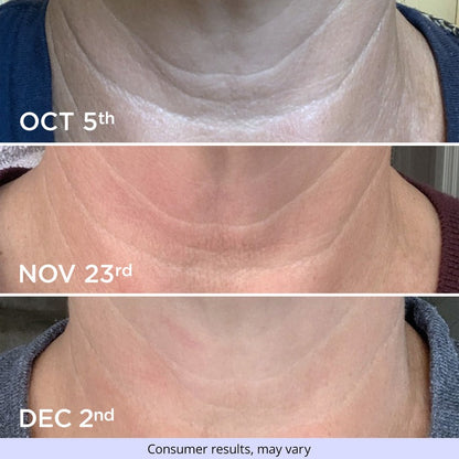 Natural™ Tighten & Lift Firming Neck Cream for Crepey Skin